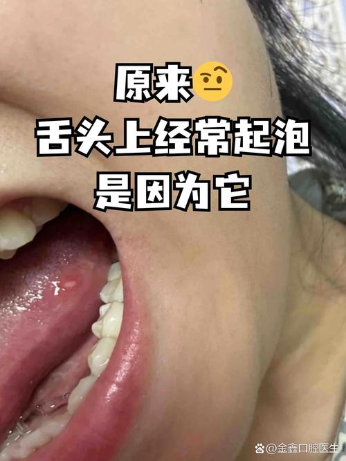  神奇的味蕾体验——舌头进入嘴里吃小豆豆